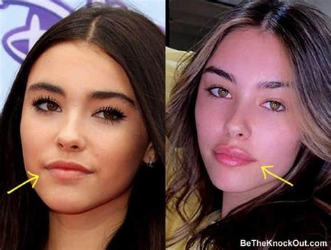 madison beer plastic surgery|Madison Beer Denies Plastic Surgery Rumors After。